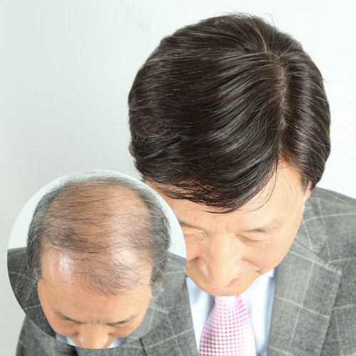 슬라이더